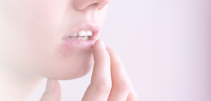Finger berühren Lippen, die von Herpes / Bläschen betroffen sind.