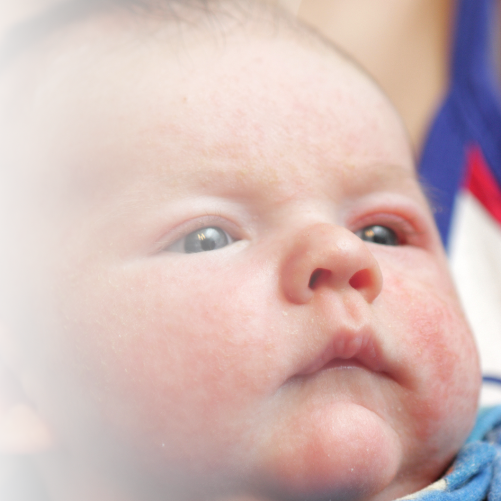 Gesicht eines Babys mit Neurodermitis