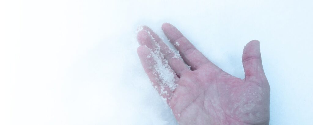 Frostbeulen: Hand im Schnee