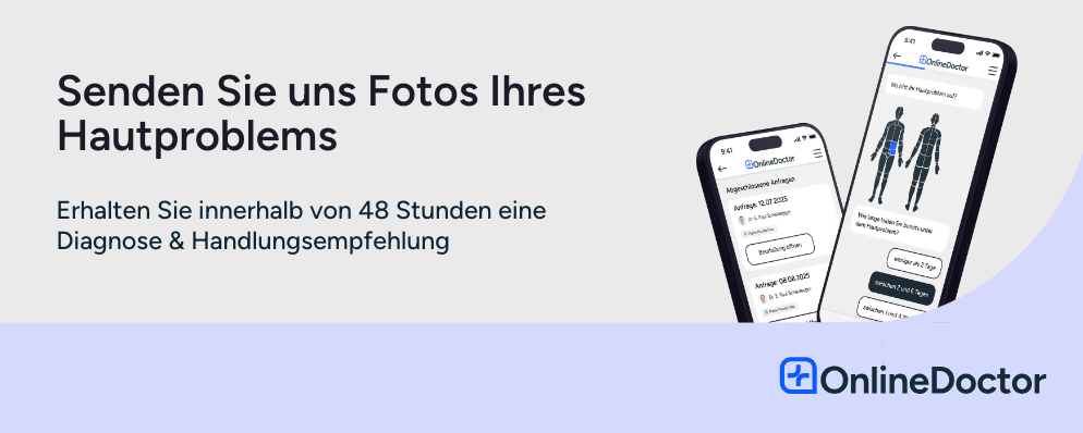 Banner zur Einsendung von Hautfotos: Erhalt einer Diagnose und Handlungsempfehlung innerhalb von 48 Stunden.