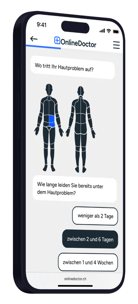OnlineDoctor Website zur Hautdiagnose mit Auswahl der Körperstelle und Dauer der Hautbeschwerden