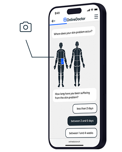 OnlineDoctor website for skin diagnosis with selection of body area and duration of symptoms