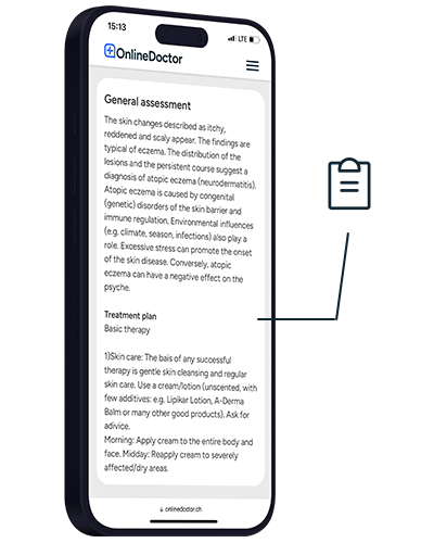 OnlineDoctor website with treatment recommendation
