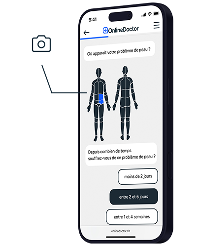 Site web OnlineDoctor pour le diagnostic cutané avec sélection de la zone du corps et durée des symptômes