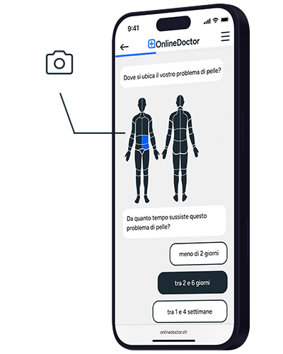 Sito web di OnlineDoctor per la diagnosi cutanea con selezione della zona del corpo e durata dei sintomi