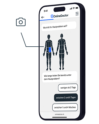 OnlineDoctor Website zur Hautdiagnose mit Auswahl der Körperstelle und Dauer der Hautbeschwerden