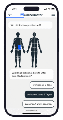 OnlineDoctor Website zur Hautdiagnose mit Auswahl der Körperstelle und Dauer der Hautbeschwerden