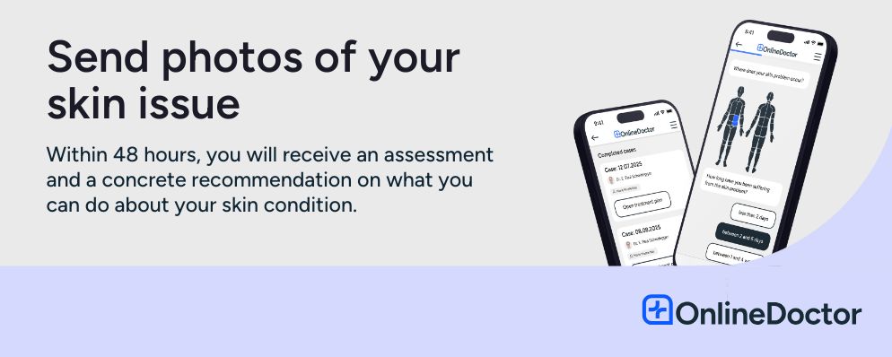 Send photos of your skin issue. Within 48 hours, you will receive an assessment and a concrete recommendation.